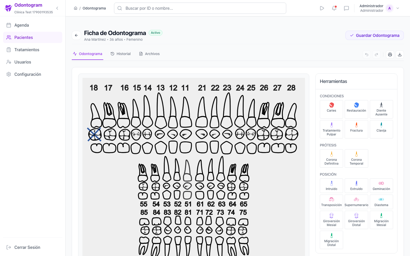 Digital Odontograms