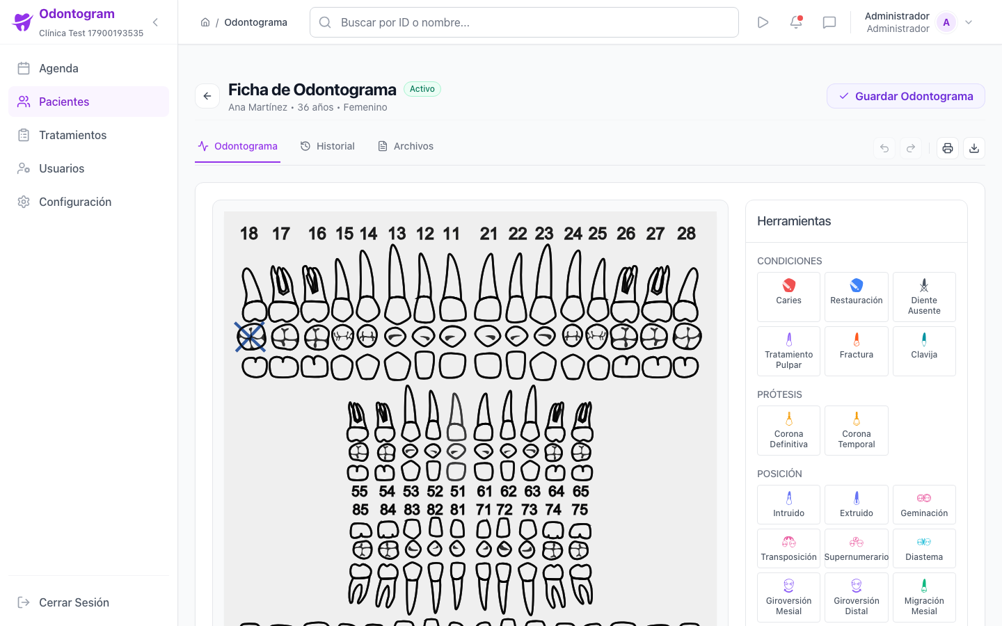 Editor de odontograma no desktop com a carta dental completa