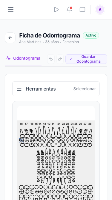 Editor de odontograma em um celular